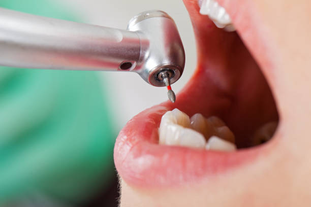 Best Urgent Care for Lost Fillings or Crowns in , OH